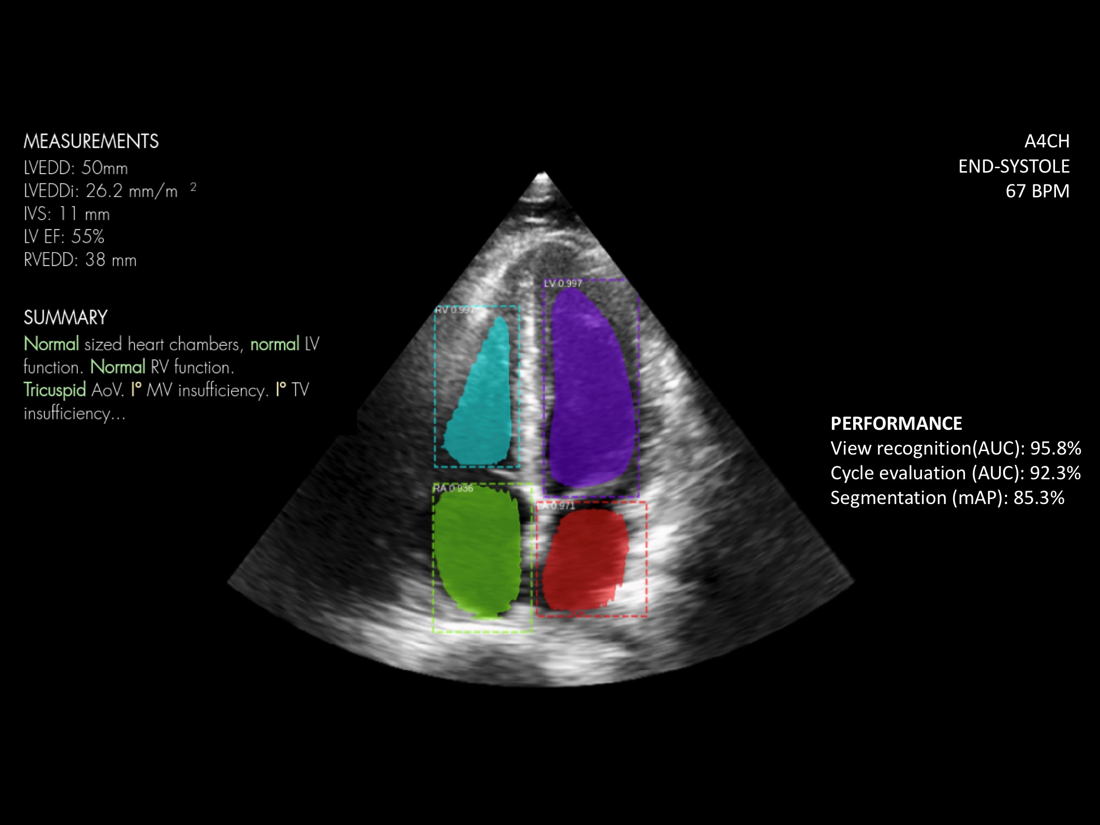 Startup of the Week: Ligence